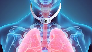 Tracheostomy vs Laryngectomy [upl. by Nanda922]