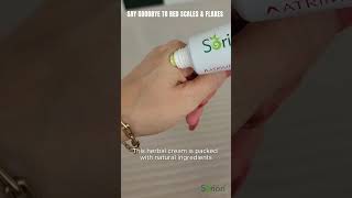 Sorion Cream and Dry Itchy Scaly Flakes sorion skincare skincareproducts [upl. by Immanuel620]