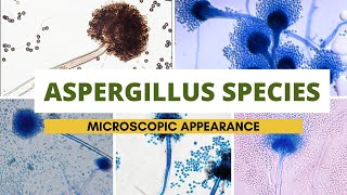 Aspergillus species microscopic appearance  Aspergillus identification Clear explanation [upl. by Cassil894]