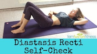 How To Test for Diastasis Recti [upl. by Larimore]