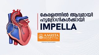 Introducing Impella for the first time in Kerala  Amrita Hospitals [upl. by Betty]