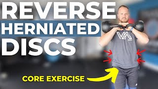 Reverse Herniated Discs With This Core Exercise Front Rack Carry [upl. by Shannan]