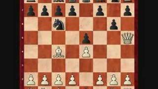 How to beat the four move checkmate [upl. by Keeler380]