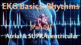 EKG Series 04 of 07 Rhythms  Atrial amp SVT rhythms 20 minutes of practice questions [upl. by Hannej382]