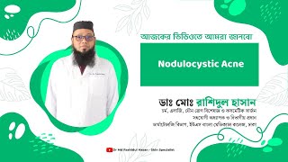 Nodulocystic acne বা বড় বড় গোটা ও পুজ যুক্ত ব্রণ [upl. by Gordon414]