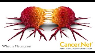 شرح metastasis باثوفيسيولجى  pathophysiology  تمريض [upl. by Ernaline350]