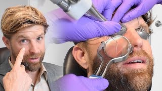 How to Get Rid of Spider Veins on Face using Vascular Lasers with Dr Kian Karimi [upl. by Ritter]