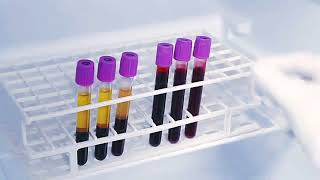 HbA1c Test ProcedureDemonstrationBlood SampleALERE ABBOTT [upl. by Ajna]