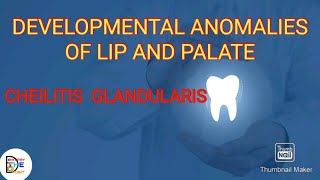 DEVELOPMENTAL ANOMALIES OF LIP amp PALATE PART 2 CHEILITIS GLANDULARIS [upl. by Nautna425]