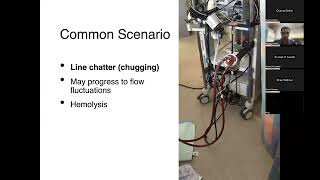 Troubleshooting VA ECMO in the Cardiac Surgery ICU [upl. by Kaye]