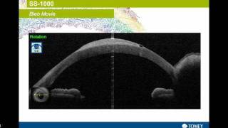 Optical Coherence Tomographer [upl. by Zelten]