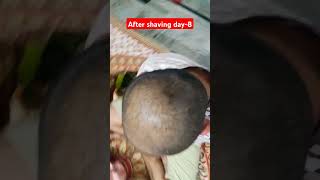 After hair shaving day 8 stop hair loss finasteride stophairfall ytshorts [upl. by Goren]