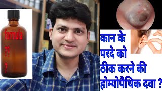 कान का पर्दा फटना । Homeopathic Medicine For Perforated Eardrum  explain  My formula [upl. by Leslie]