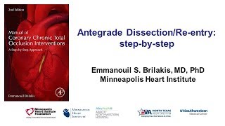 Antegrade dissection and reentry stepbystep [upl. by Suhpoelc]