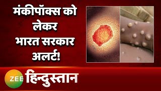 Breaking News Corona गया नहींMonkey pox आ गया  WHO  Monkeypox Outbreak  Virus  Latest News [upl. by Dunning]