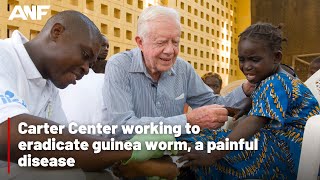 Carters legacy Eradicating guinea worm disease [upl. by Reece28]