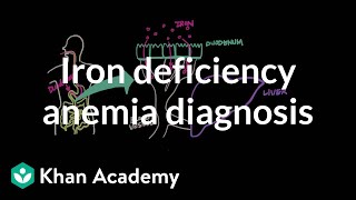 Iron deficency anemia diagnosis  Hematologic System Diseases  NCLEXRN  Khan Academy [upl. by Barnum921]