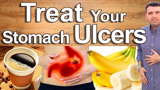 Do This And Cure Your Stomach Pain Gastritis and Ulcers  Best Natural Treatment of Stomach Pain [upl. by Yrrehs]