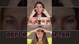 HOW TO REMOVE UNDEREYE BAGS LINK IN BIO [upl. by Patricio399]