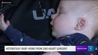 Heterotaxy baby home from 2nd heart surgery [upl. by Mich]