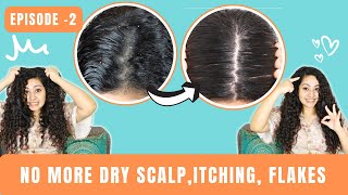 DRY ITCHY FLAKY Scalp Routine amp Products  SCALP CARE SERIES EP2  Thrive Co Scalp Care [upl. by Aicinat623]