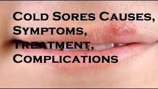 Cold Sores Causes Symptoms Treatment Complications [upl. by Guillemette]