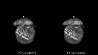 Stereoskopische CTVideos [upl. by Brandenburg]