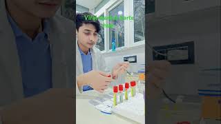 Viral marker test HCV HIV HBsAG VDRL bloodtestkaisehotahai bloodtest [upl. by Ahsirahc]