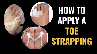 How Do I Do Toe Strapping Dislocated and Fractured Toe [upl. by Bittencourt942]