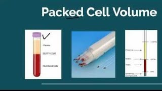 HCT Hematocrit Test PCV Packed cell Volume Test [upl. by Huntington]