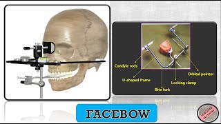 Facebow  Types and Parts of a Facebow [upl. by Miharba]