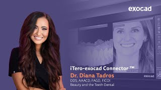 Revolutionizing Collaboration with the iTeroexocad Connector™ [upl. by Adnilav]