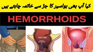 How To Get Rid Hemorrhoid [upl. by Notlad]