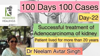 100 DAYS 100 CASES  DAY22 ADENOCARCINOMA OF KIDNEY  DR NEELAM AVTAR SINGH  VIDEO 194 [upl. by Starla]