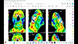 Hydrogen rich water thermography of the body analysis tests [upl. by Enait]