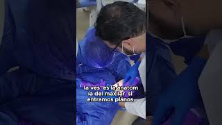 Anatomía del maxilar lo que debes saber cuidatusonrisa odontologia dentista [upl. by Meijer564]