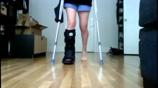 Walking After Ankle Surgery Days 1 amp 2 [upl. by Suilmann]