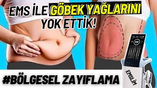 GÖBEK YAĞLARINI YOK ETTİK  EMS İLE BÖLGESEL ZAYIFLAMA [upl. by Haceber]