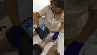 Excimer Lazer ile Psoriasis Tedavisi  Dr Kadriye AKAR [upl. by Enneillij]