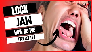 How do we treat Lock Jaw Acute Dislocation of Jaw [upl. by Timotheus]