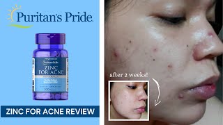 Puritans Pride  Zinc Supplements for Acne Before and After [upl. by Berard]