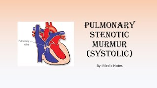 Pulmonary stenotic murmur  description causes pathophysiology [upl. by Dimmick385]