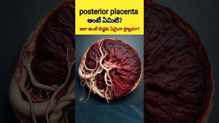 Posterior placenta shortsvairalshortsposteriorplacenta [upl. by Teik197]