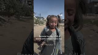 Palestinian child cries in pain after being displaced in northern Gaza [upl. by Pfister953]