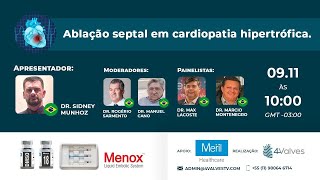 Ablação Septal em Cardiopatia Hipertrófica [upl. by Enner15]