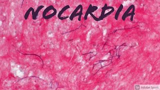 Nocardia Infection Grampositive Partially Acid Fast Aerobic Filamentous Bacteria [upl. by Olnay]