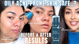 How Derma Co ABC Peptide Exfoliator Serum Works on Oily Acne Prone Skin Dr V Skin Renew Review [upl. by Nnairret]