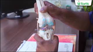 Life After Anterior Cruciate Ligament ACL Surgery  Dr Atul Mishra Fortis Hospital Noida [upl. by Hannie]