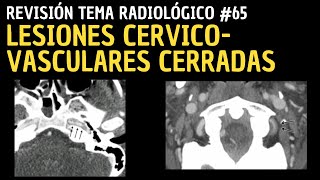 Revisión de Tema 65 Lesiones cervicovasculares cerradas [upl. by Sweet]