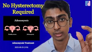 Adenomyosis Treatment No Hysterectomy Needed  Antai Hospitals [upl. by Ecissej550]